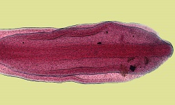 Diphyllobothrium latum